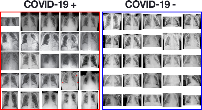 Определяем COVID-19 на рентгеновских снимках с помощью Keras, TensorFlow и глубокого обучения - 3