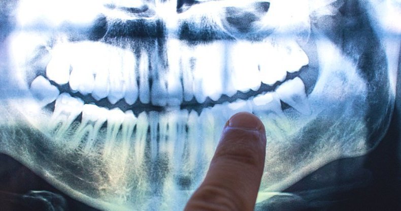 Зубы хранят в себе летопись нашей жизни: необычное открытие