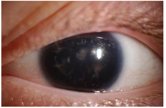 «Красивые глаза» как симптом болезни - 5