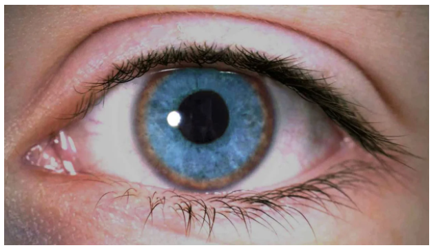 «Красивые глаза» как симптом болезни - 7