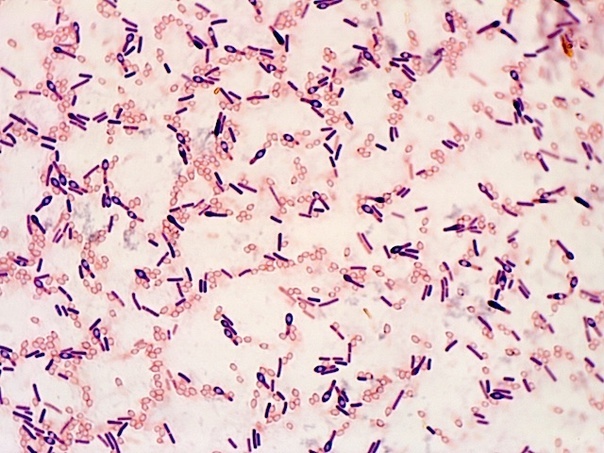 Возбудитель столбняка Clostridium tetani — окраска по Грамму. В препарате можно видеть как палочковидные вегетативные формы, так и споры в форме «ракеток для тенниса».