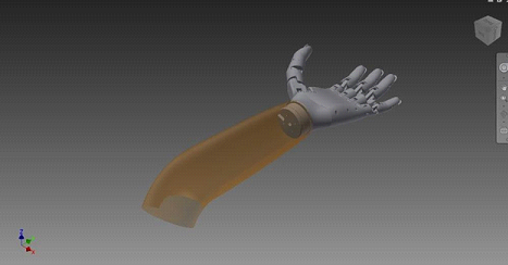 Российские протезы пальцев созданные с помощью 3D печати