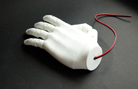 Российские протезы пальцев созданные с помощью 3D печати