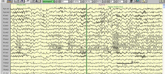 Модулятор REM фазы сна