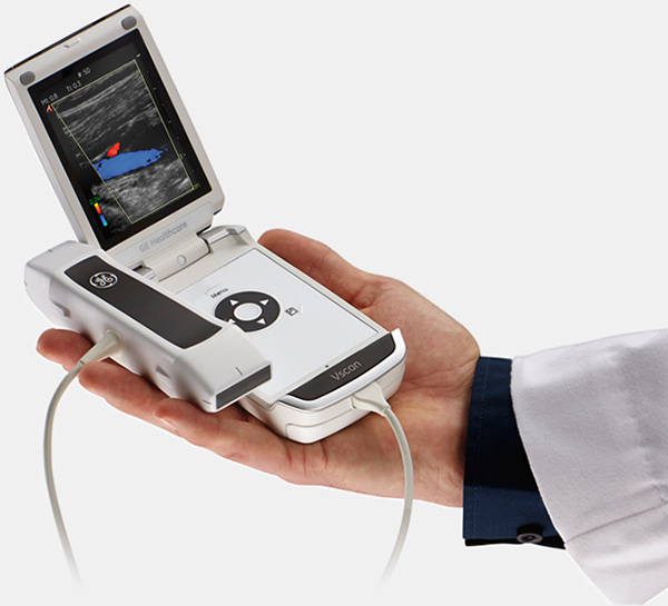 Vscan dual probe ultrasound GE Expands Vscans Capabilities with Dual Ultrasound Probes in Single Handheld Device