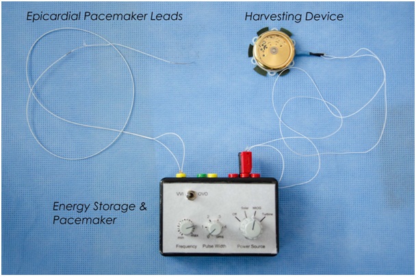 Электрокардиостимулятор без батареек работает как часы