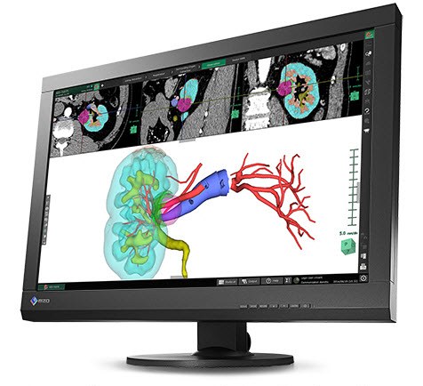 Eizo выпустила 24-дюймовый монитор для клинической диагностики RadiForce MX242W - 1