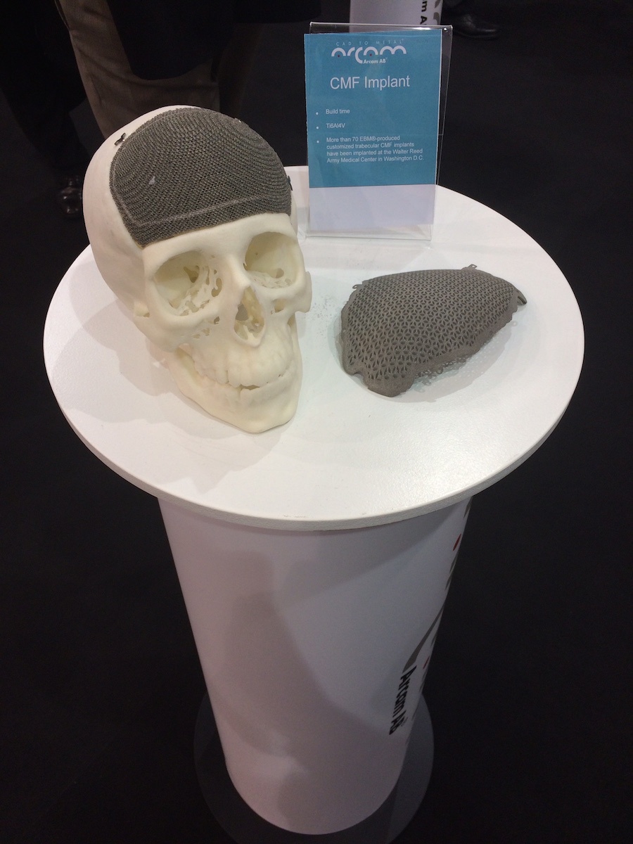 Euromold 2014 — Все, что нужно знать о перспективах 3D-печати - 30