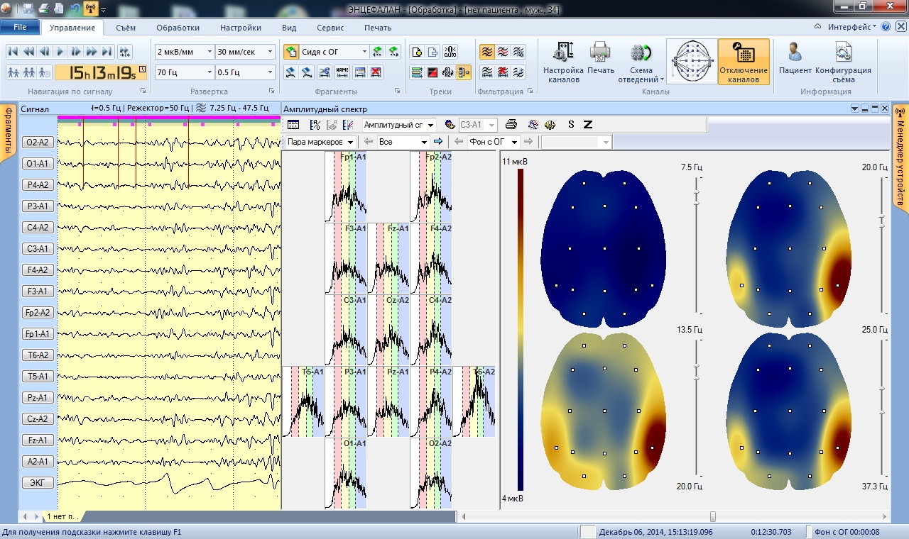 Программа Энцефалан. Энцефалан-131-03 программное обеспечение. Программа Энцефалан инструкция. Протокол Энцефалан ПСГ.