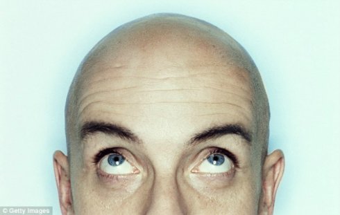 Потерянные волосы восстановит иммунитет - 1 Потерянные волосы восстановит иммунитет