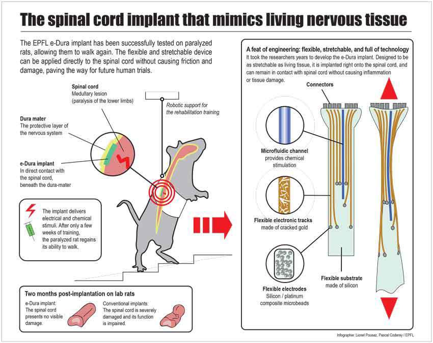 Имплантат способен восстановить функции повреждённого спинного мозга - 3
