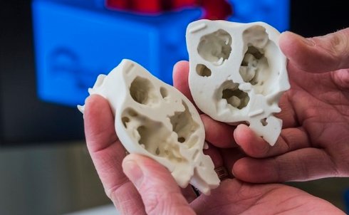 На 3D принтере напечатали сердца для детей