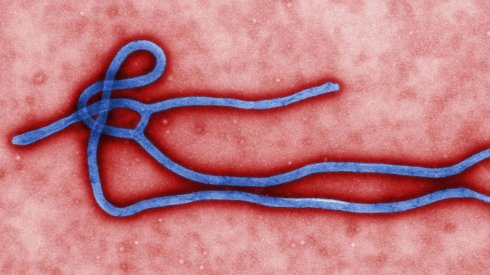 10 причин, по которым Эбола не приведет к концу света