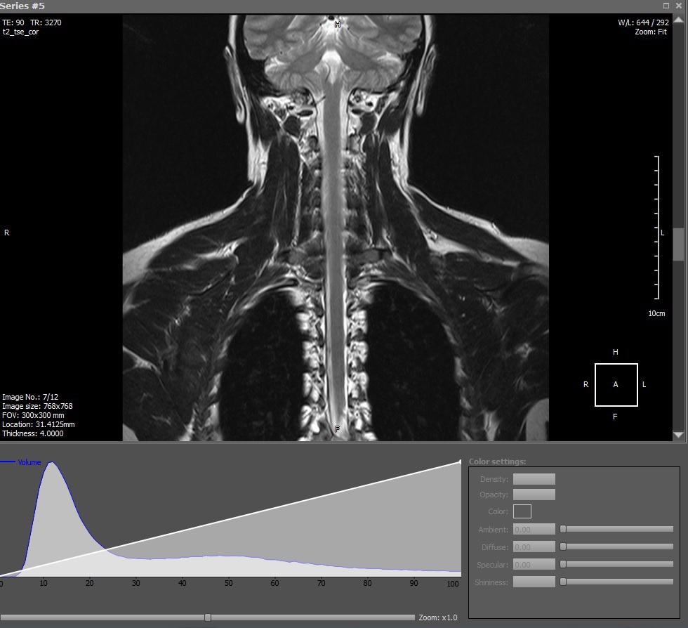 DICOM Viewer изнутри. Воксельный рендер - 2