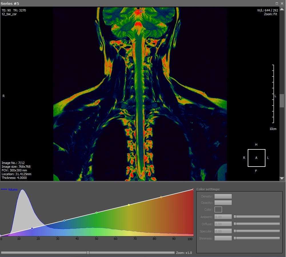 DICOM Viewer изнутри. Воксельный рендер - 4