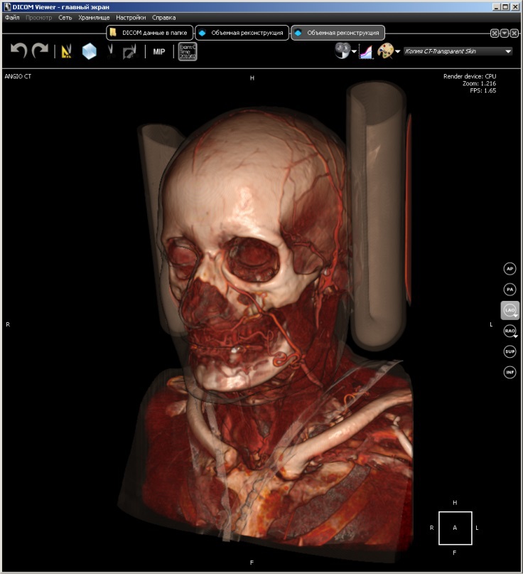 DICOM Viewer изнутри. Воксельный рендер - 6