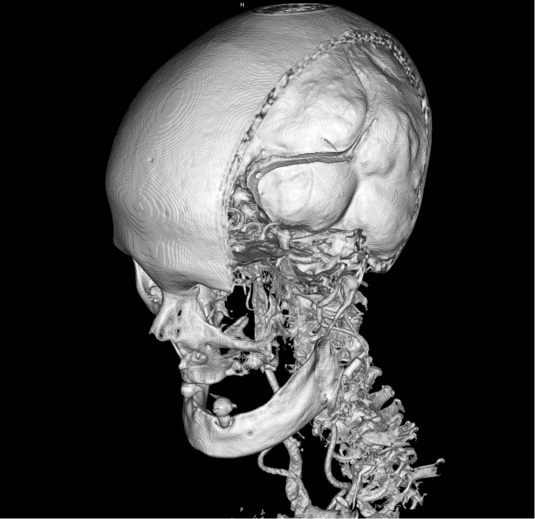 DICOM Viewer изнутри. Воксельный рендер - 8