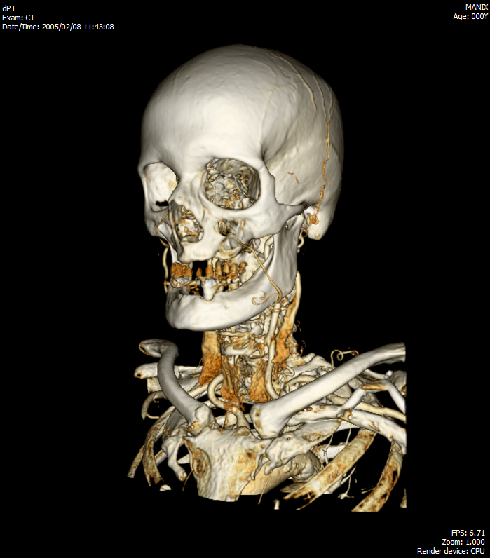 DICOM Viewer изнутри. Воксельный рендер - 1