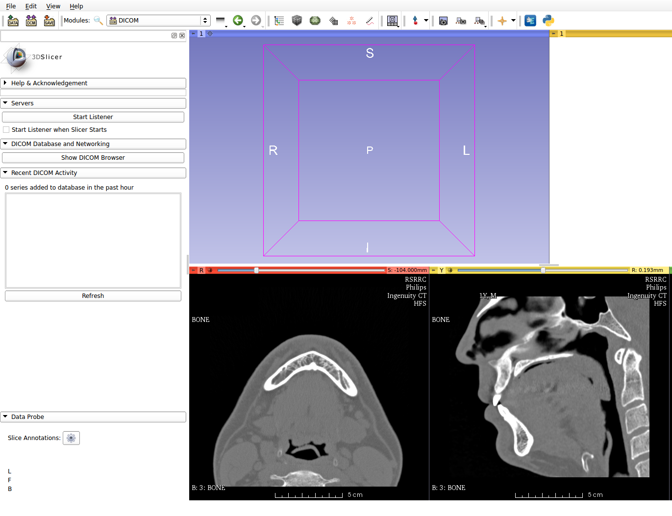 Как я пытался лечиться по ДМС, а получил 3D модель головы и чуть больше здоровья за свои деньги - 3 Как я пытался лечиться по ДМС, а получил 3D модель головы и чуть больше здоровья за свои деньги - 3