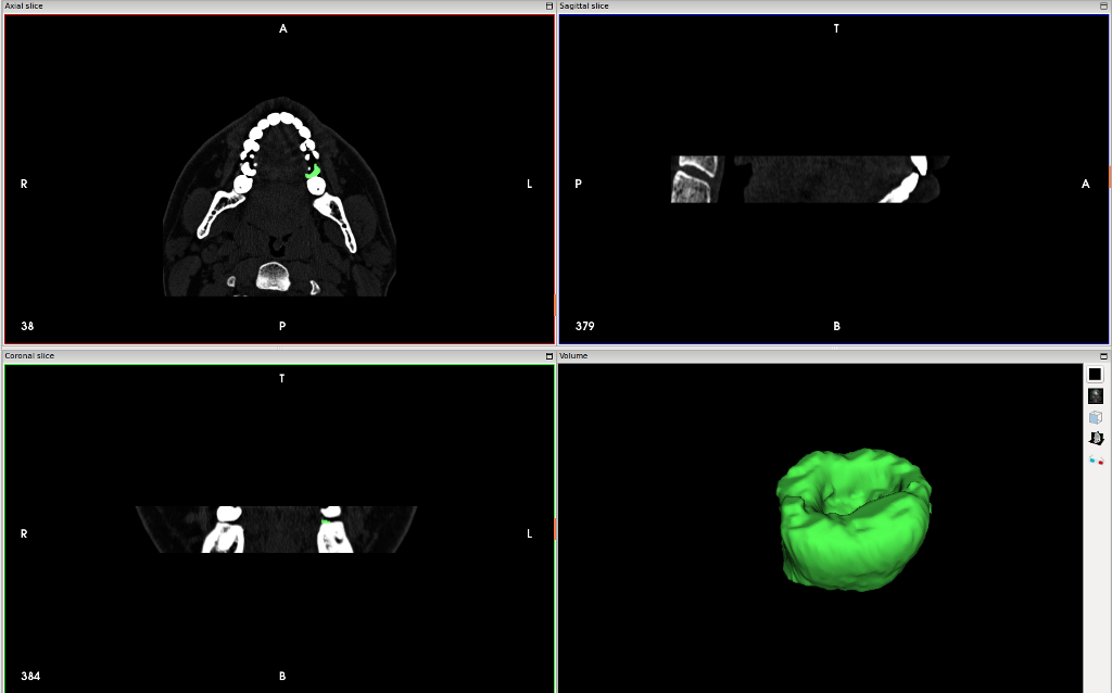 Как я пытался лечиться по ДМС, а получил 3D модель головы и чуть больше здоровья за свои деньги - 7 Как я пытался лечиться по ДМС, а получил 3D модель головы и чуть больше здоровья за свои деньги - 7