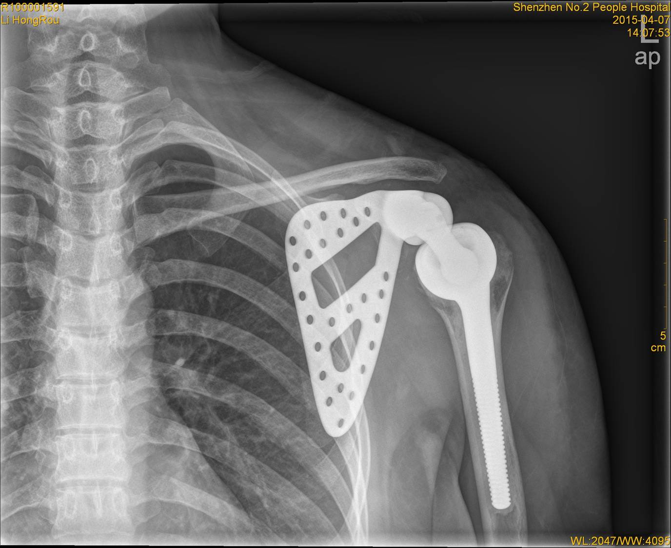 Титановые лопатки с помощью 3D-принтера - 1 image