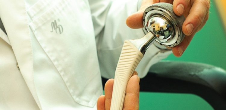 Впервые в России имплантировали отечественный протез тазобедренного сустава из нанокерамики - 1 image