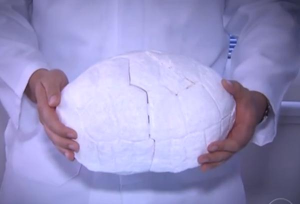 Пострадавшая в лесном пожаре черепаха получила распечатанный на 3D принтере панцирь вместо родного - 3