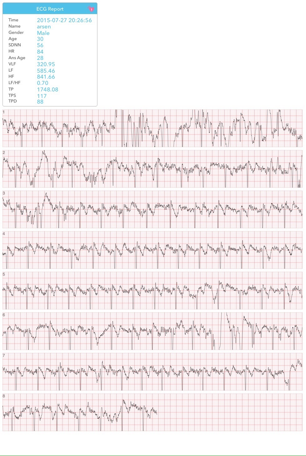 Wme2 — на что способен браслет от авторов первого iPhone: ЭКГ, давление и пульс из двух пальцев - 6