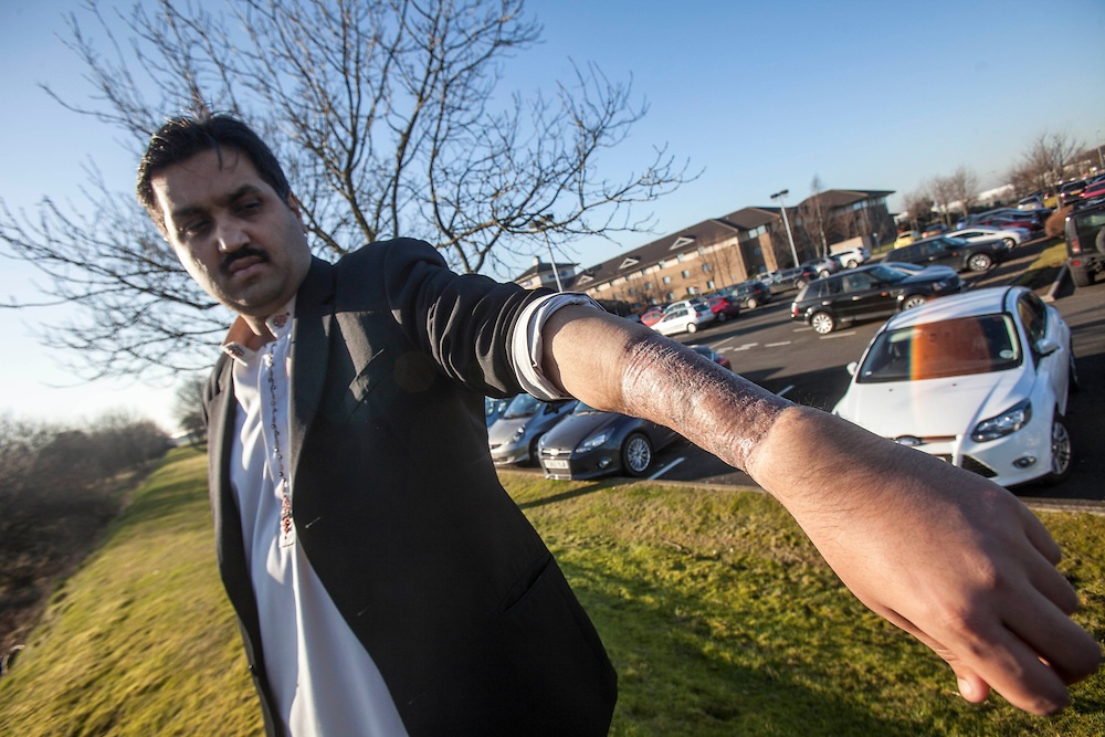 Первый в мире бионический пенис - 3 image