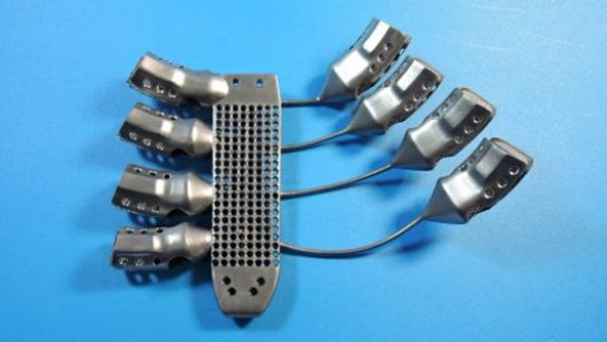 Вот оно — будущее: Раковому больному пересадили 3D-напечатанные титановые ребра и грудину - 4 2