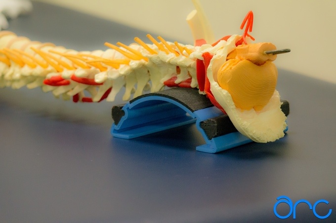 Как исправить осанку с помощью Kickstarter'а: подборка интересных «неврологических» проектов - 1 Как исправить осанку с помощью Kickstarter'а: подборка интересных «неврологических» проектов - 1