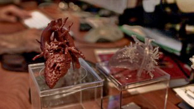 Сердце, напечатанное на 3D-принтере спасло 4-летнюю Миа Гонсалес - 2