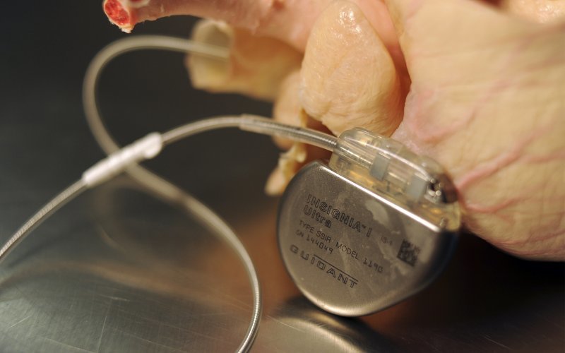 Можно ли взломать кардиостимулятор: краткая история безопасности медицинских устройств - 1 Можно ли взломать кардиостимулятор: краткая история безопасности медицинских устройств - 1