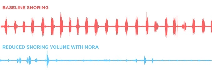 Современные технологии избавляют от храпа: неинвазивная система Nora - 6