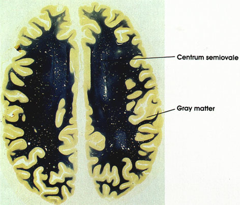 История изучения мозга от Древнего Египта до начала XX века - 27 История изучения мозга от Древнего Египта до начала XX века - 27
