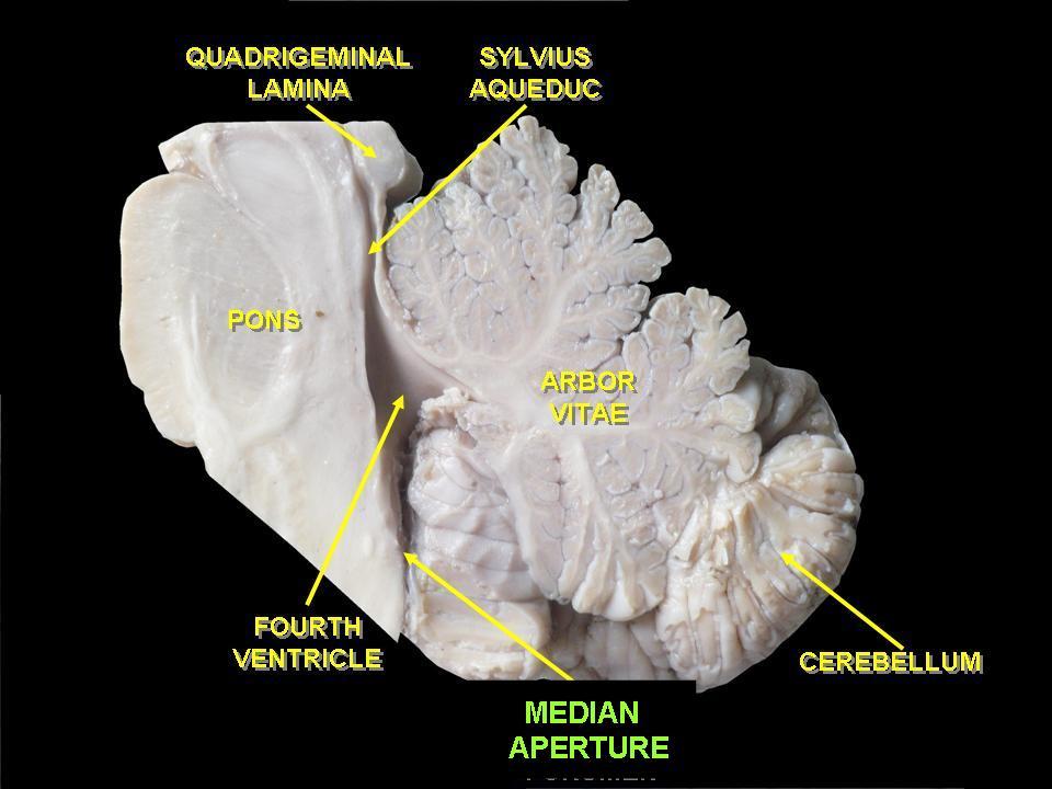 История изучения мозга от Древнего Египта до начала XX века - 46 История изучения мозга от Древнего Египта до начала XX века - 46