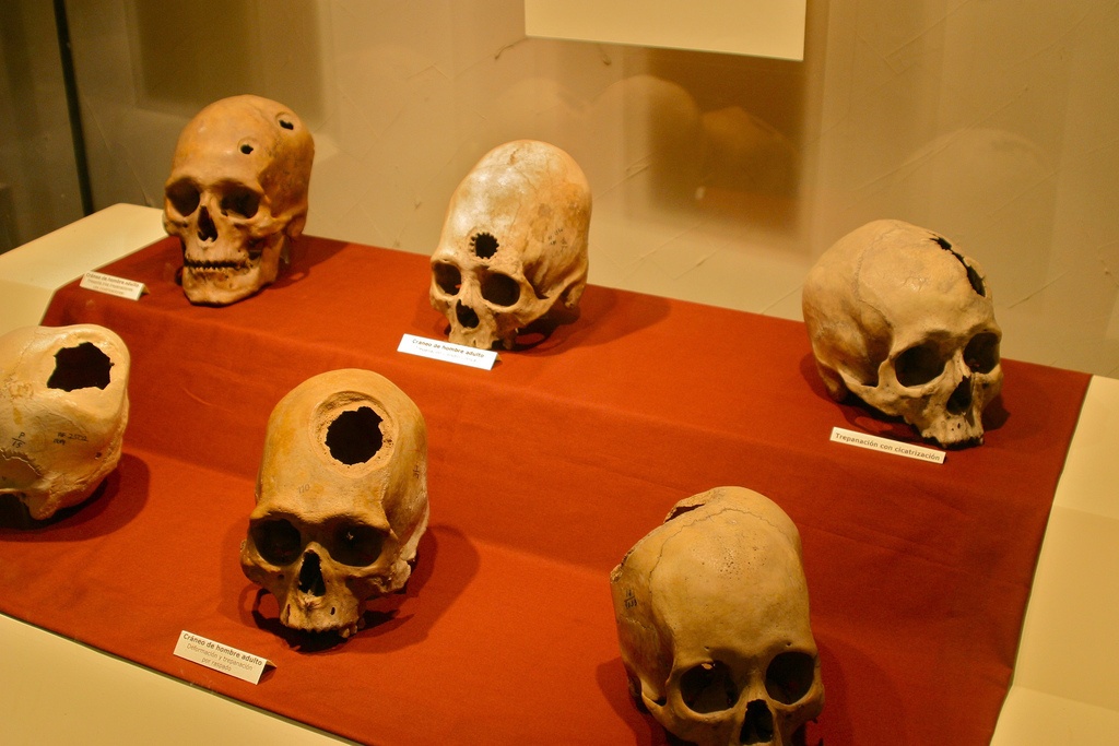 История изучения мозга от Древнего Египта до начала XX века - 6 История изучения мозга от Древнего Египта до начала XX века - 6