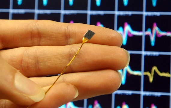 Размышления о влиянии технологии RAM, позволяющей навсегда «забыть» о потере памяти в мозге людей - 1 image