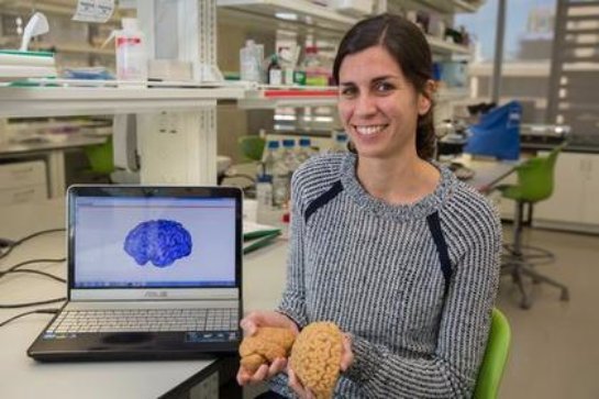 Ученых удивило найденное отличие между мозгами человека и обезьяны - 1 1