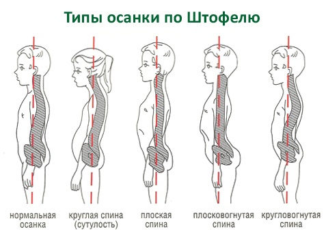 Организация рабочего места с позиции здоровья спины (и не только) - 3