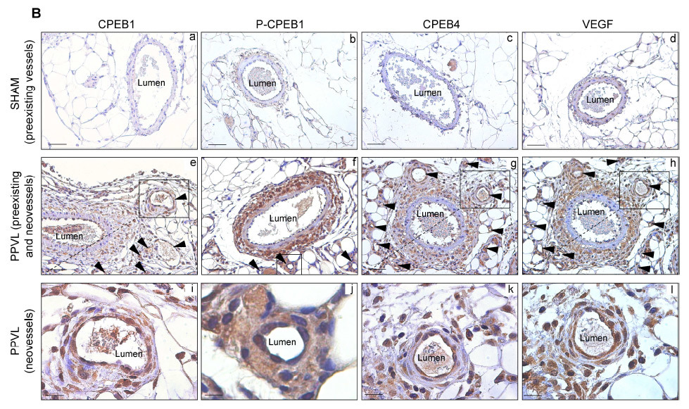 Найдено потенциальное лекарство от цирроза печени - 3