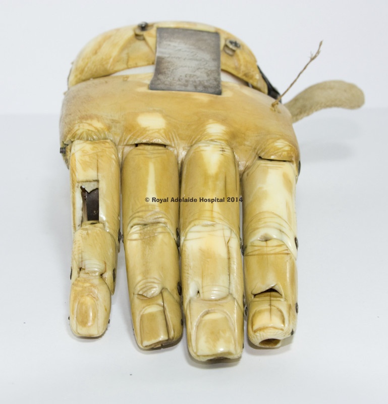 Создатели распечатанного на 3D принтере протеза руки вдохновились проектом 1845 года - 4
