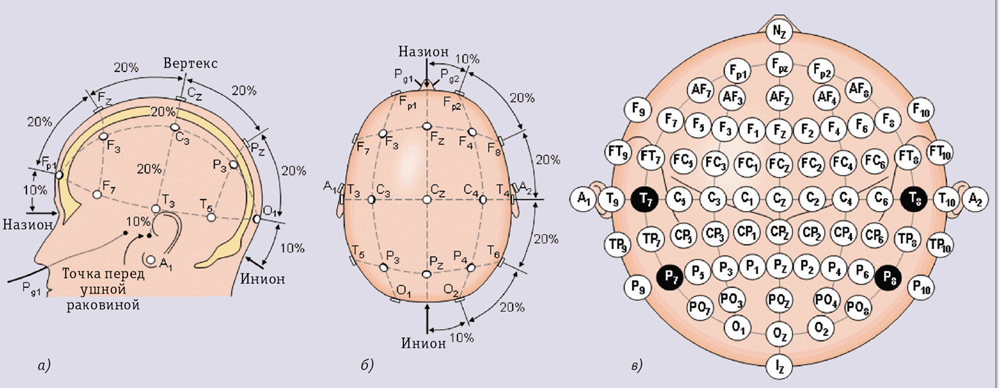 Про волнения в головах - 15 Про волнения в головах - 15