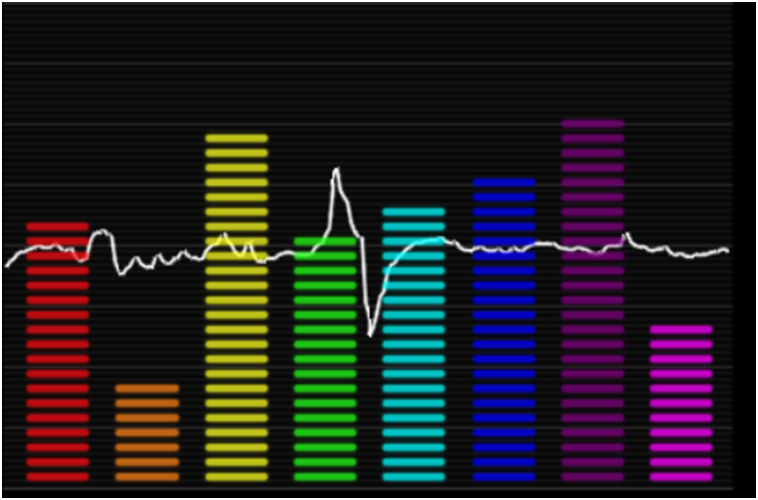 Про волнения в головах - 5 Про волнения в головах - 5