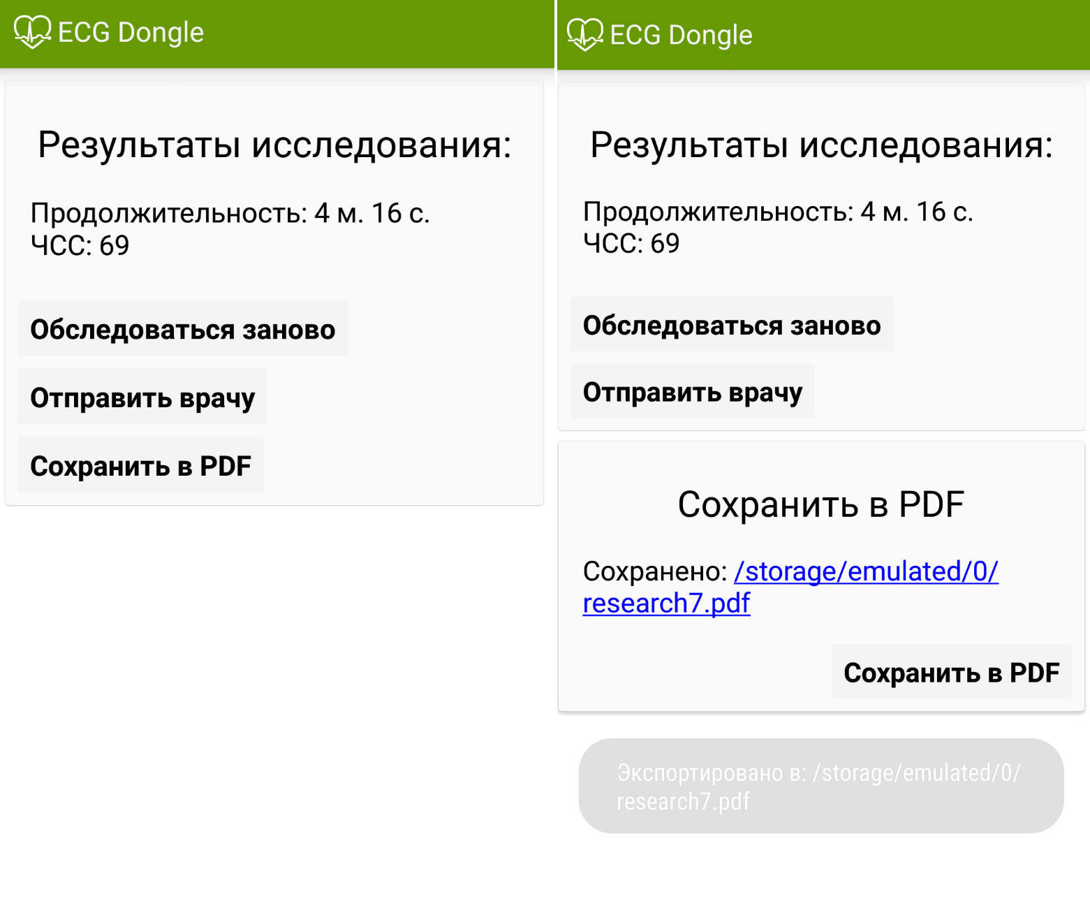 ЭКГ на дому, или сделано в России: отечественные разработчики представили кардиофлешку - 6