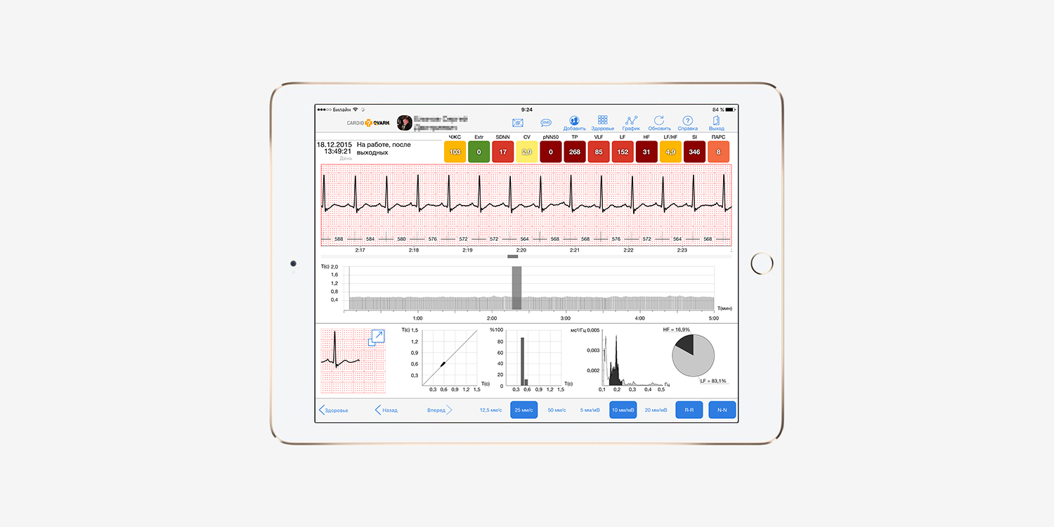 CardioQVARK — мобильный гаджет для контроля работы сердца - 2