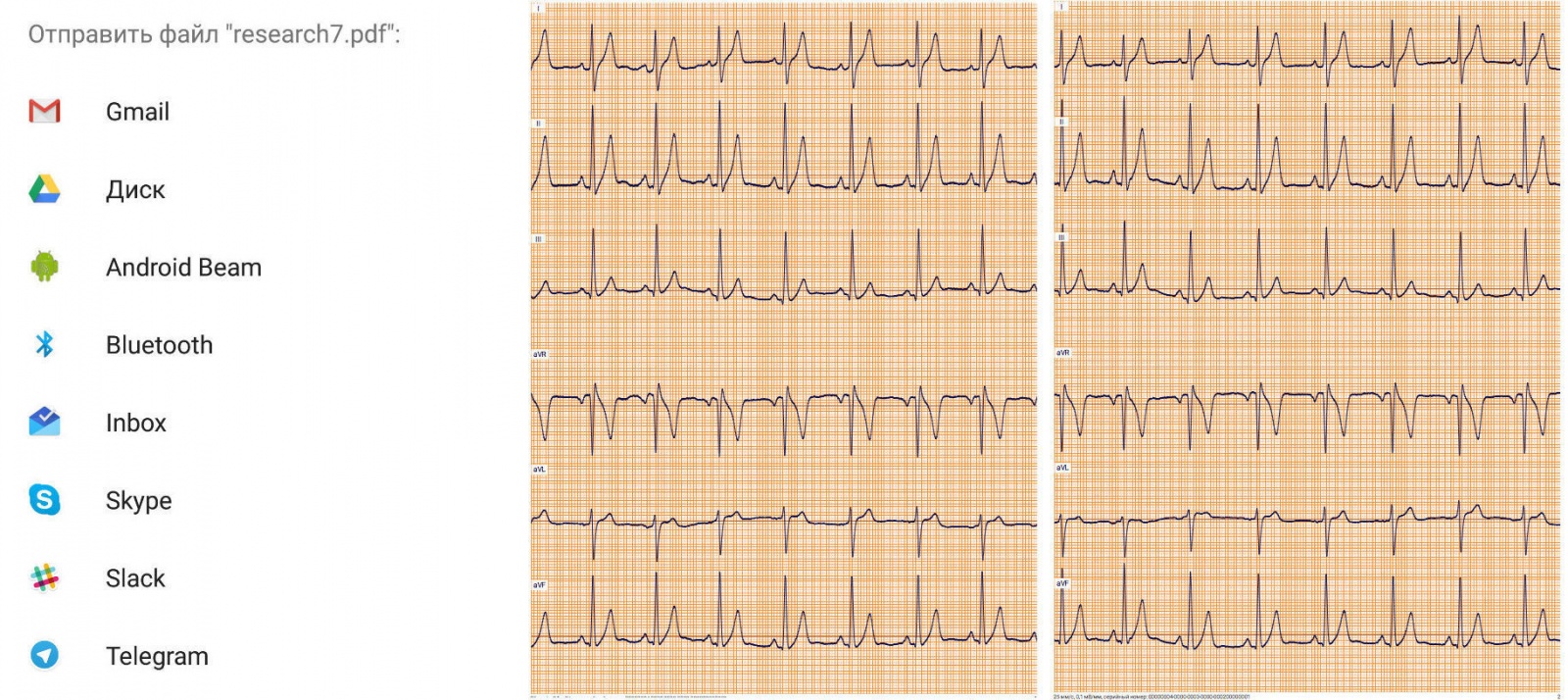 ЭКГ на дому: подборка портативных аппаратов - 27
