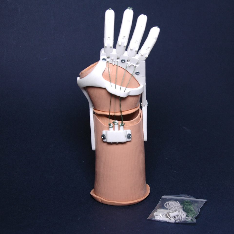 Как «Моторика» делает протезы для детей - 10 Как «Моторика» делает протезы для детей - 10