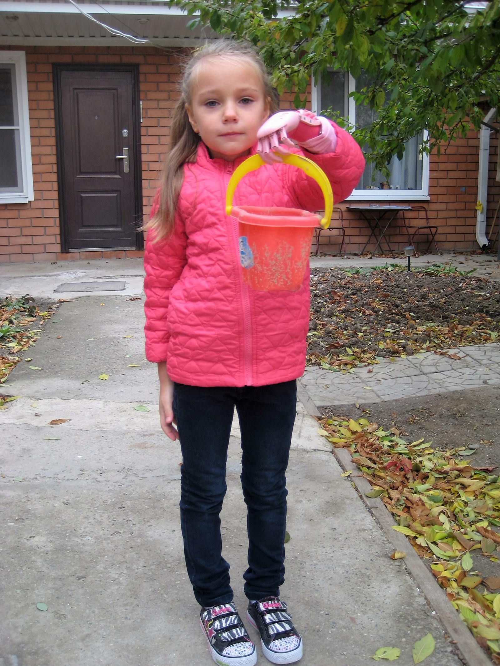 Как «Моторика» делает протезы для детей - 12 Как «Моторика» делает протезы для детей - 12