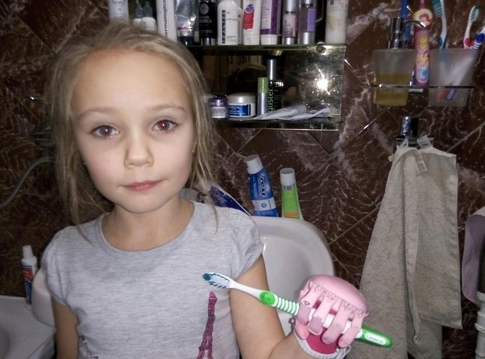 Как «Моторика» делает протезы для детей - 13 Как «Моторика» делает протезы для детей - 13